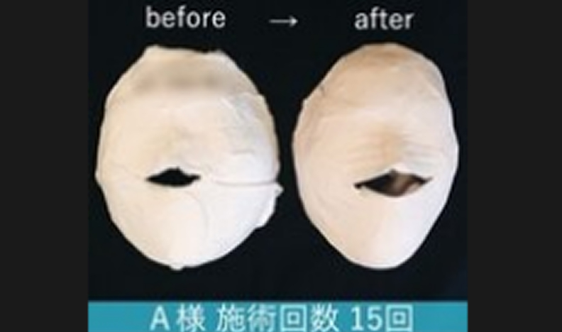 うる艶肌石膏パック