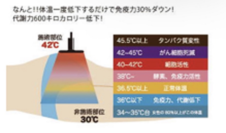 ラジオ波